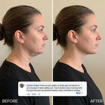 PDRN Collagen Gua Sha Neck Wrinkle Cream